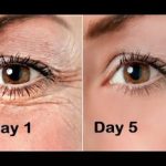 5 simple tips to get rid of eye wrinkles